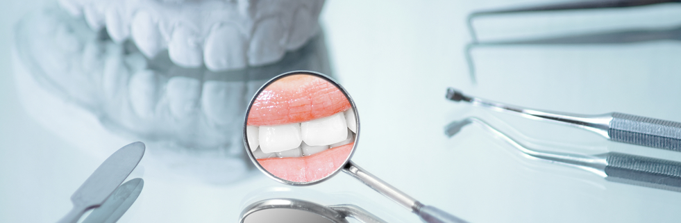 Restorative Dentistry in Northridge, CA